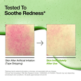 Anua Azelaic Acid 10 Hyaluron Redness Soothing Serum for Korean Skincare-Be Yours-Korean Skincare