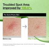 Anua Azelaic Acid 10 Hyaluron Redness Soothing Serum for Korean Skincare-Be Yours-Korean Skincare