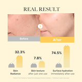 Medicube Kojic Acid Turmeric Night Wrapping Mask - Be Yours -