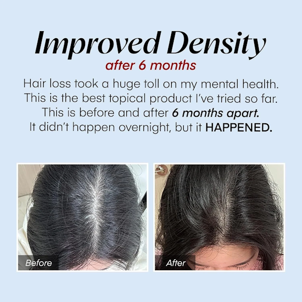 Seapuri Scalpy Hair Ampoule for Hair Loss - Hair Growth Serum