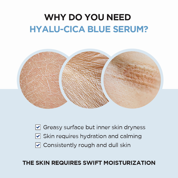 SKIN1004 - Madagascar Centella Hyalu-Cica Blue Serum