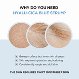 SKIN1004 - Madagascar Centella Hyalu - Cica Blue Serum - Be Yours - 
